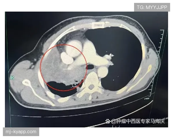 VAR介入标准详解：哪些情况必须暂停比赛复查判罚？